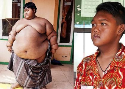 Cậu bé béo nhất thế giới nặng 200kg từng gây sốc trên mạng xã hội giờ ra sao sau 4 năm miệt mài giảm cân?