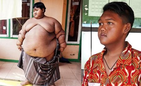 Cậu bé béo nhất thế giới nặng 200kg từng gây sốc trên mạng xã hội giờ ra sao sau 4 năm miệt mài giảm cân?